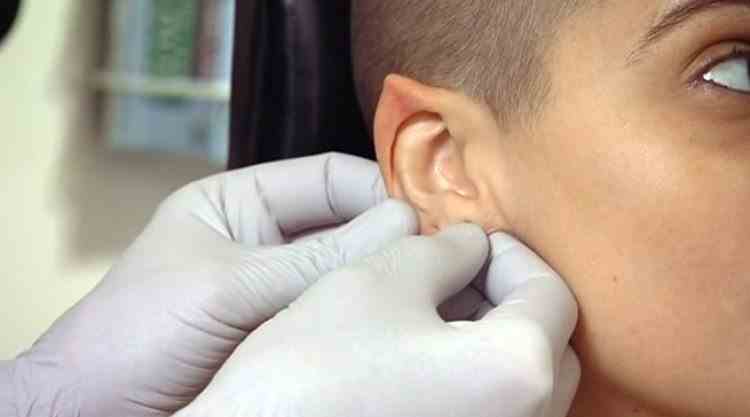 Tinerii din China și moda urechilor de elf - Piața chirurgiei estetice este în creștere puternică
